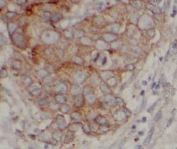 ERBB2 Mouse Monoclonal Antibody