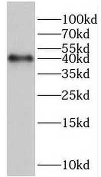 HERPUD2 Antibody