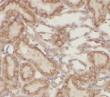 HERPUD2 Antibody