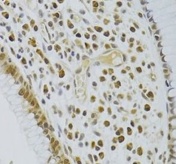 HEXIM1 Antibody