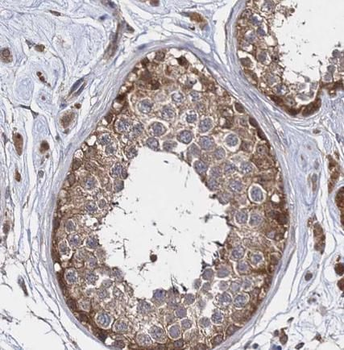 HK1 Rabbit Polyclonal Antibody