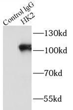 HK2 Antibody