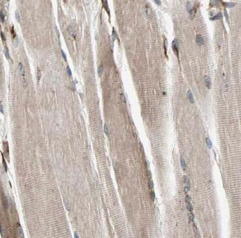 HK2 Antibody