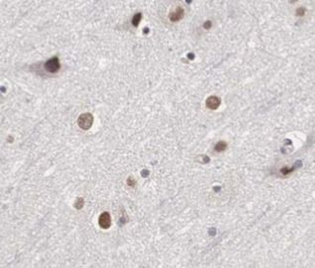 HEY1 Antibody