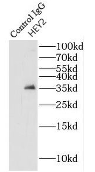 HEY2 Antibody