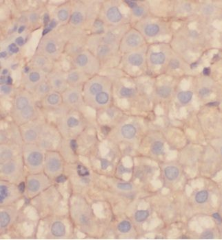HGD Antibody