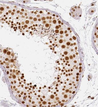 HIC1 Antibody