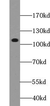 HIF1A Rabbit Polyclonal Antibody