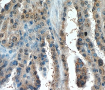 HIF1A Rabbit Polyclonal Antibody