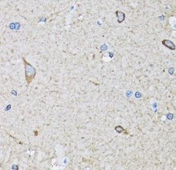 HIP1 Antibody