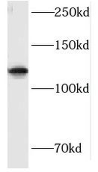 HIP1R Antibody