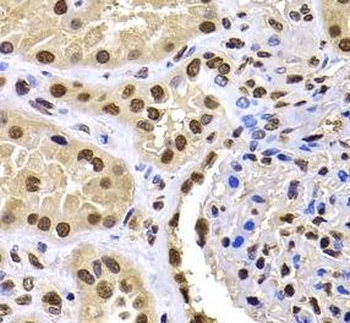 HIRIP3 Antibody