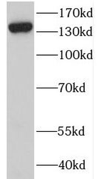 PPIP5K2 Rabbit Polyclonal Antibody