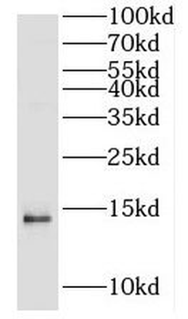 H2AC18 Rabbit Polyclonal Antibody