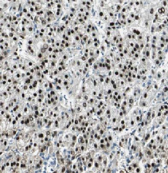 H2AC18 Rabbit Polyclonal Antibody