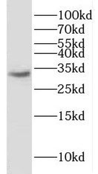 Histone H1.0 Rabbit Polyclonal Antibody