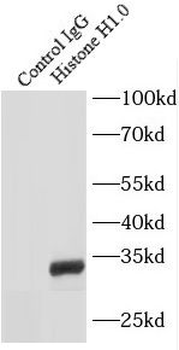 Histone H1.0 Rabbit Polyclonal Antibody