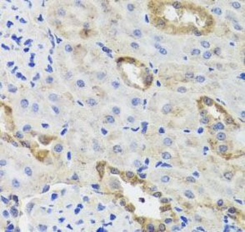 HK3 Antibody