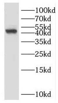 HLA A Rabbit Polyclonal Antibody