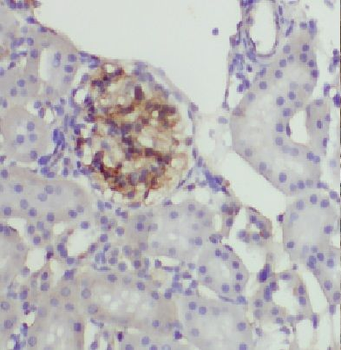 HLA A Rabbit Polyclonal Antibody