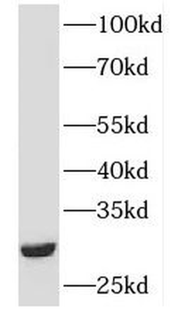 HLA DMB Rabbit Polyclonal Antibody