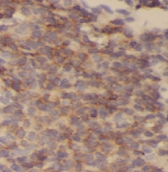 HLA DPB1 Rabbit Polyclonal Antibody