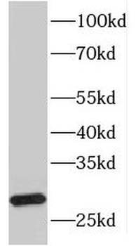 HLA DQA2 Rabbit Polyclonal Antibody