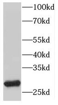 HLA-DRB1 Antibody