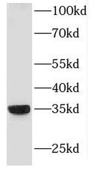 HLA DRB4 Rabbit Polyclonal Antibody