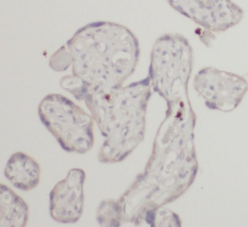 HLA-F Antibody