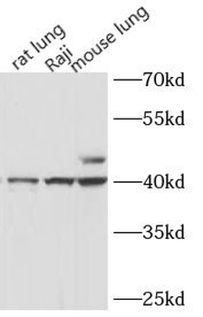 HLA F Rabbit Polyclonal Antibody
