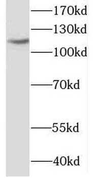 HLTF Antibody