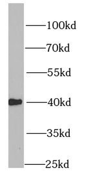 HMG20A Antibody
