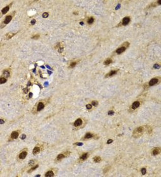 HMG20A Antibody