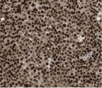HMGB2 Antibody