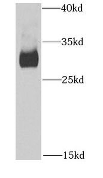 HMGCL Antibody