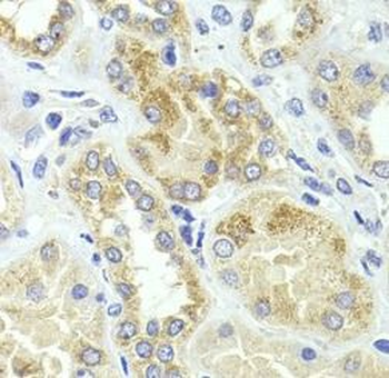 HMGCL Antibody