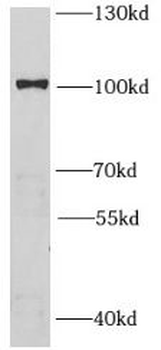 HMGCR Rabbit Polyclonal Antibody