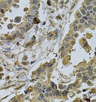 HMGCR Rabbit Polyclonal Antibody