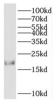 HMGN2 Antibody