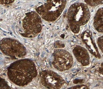 HMGN2 Antibody