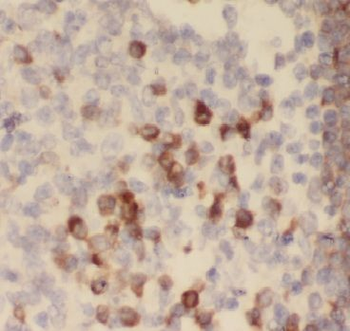 ARHGAP45 Antibody