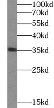 HMOX2 Rabbit Polyclonal Antibody