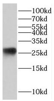 JPT1 Antibody