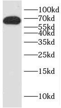 HNF1A Antibody
