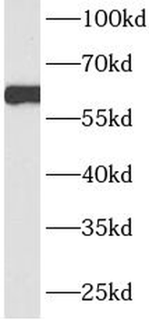 HNF1B Antibody