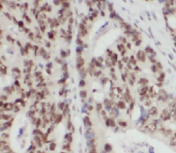 HNF1B Antibody