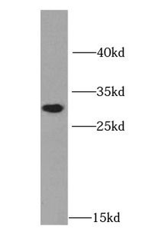 HNMT Antibody