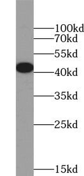 HNRNPD Rabbit Polyclonal Antibody
