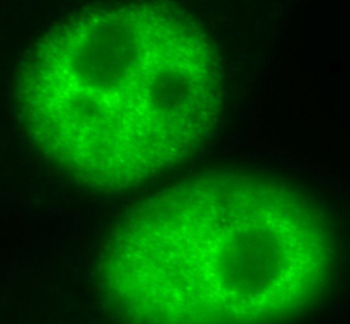 HNRNPD Rabbit Polyclonal Antibody